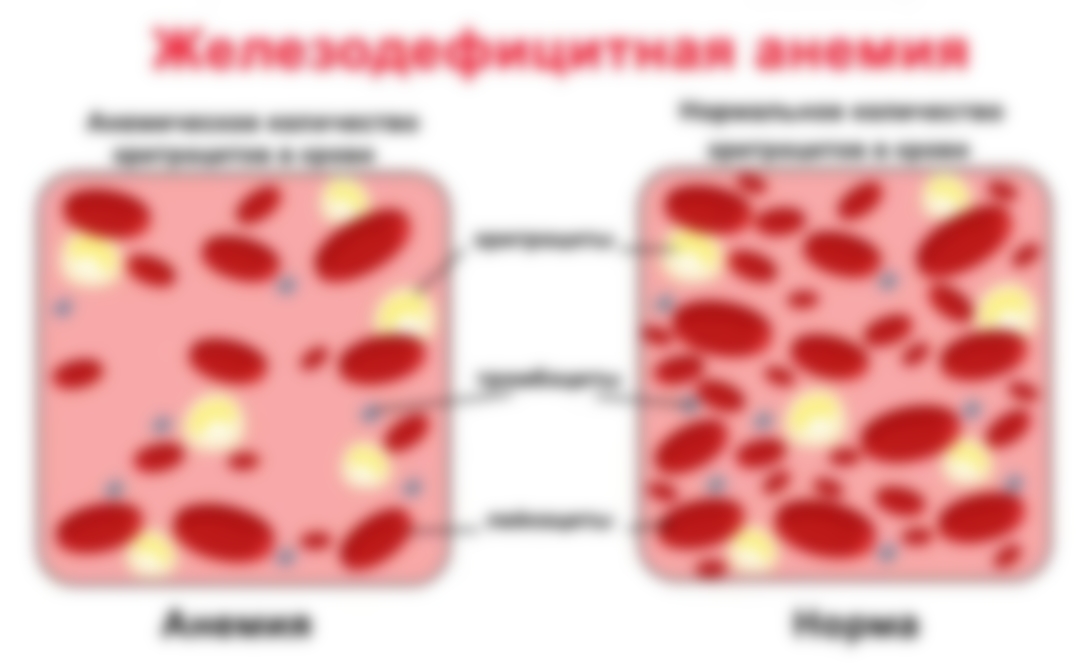 Что есть при железодефицитной анемии