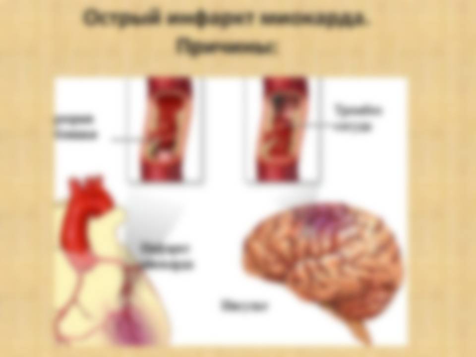 Почему болит сердце при коронавирусе и что делать