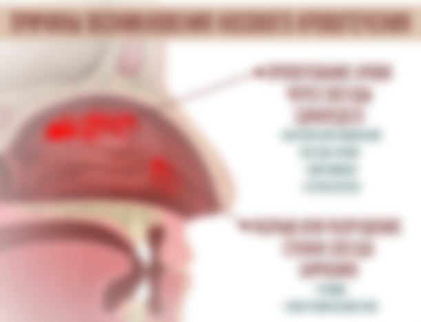 Почему идёт кровь из носа у взрослого человека