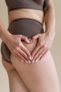 Эффективные способы избавиться от растяжек после родов. x0qh1pbfxkvshv540r